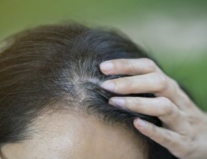 Как скрыть раннюю седину волос?